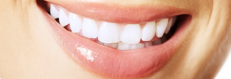 Diş beyazlatma işlemi dişleri nasıl beyazlatır?