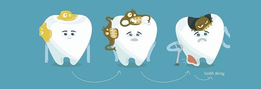 Diş Çürüğü Nasıl Önlenir?